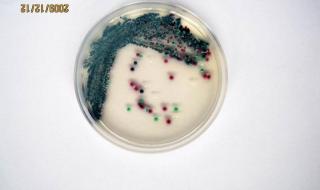微生物常用基本培养基有哪些